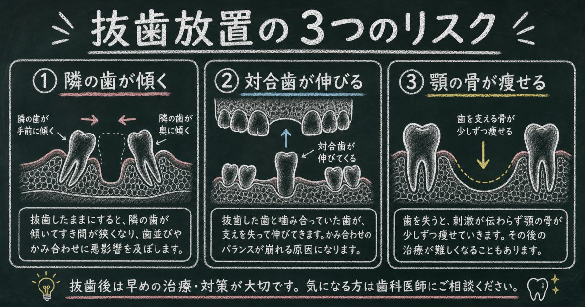 抜歯後にそのまま放置する影響とは？口腔内に起こる3つの連鎖的リスク