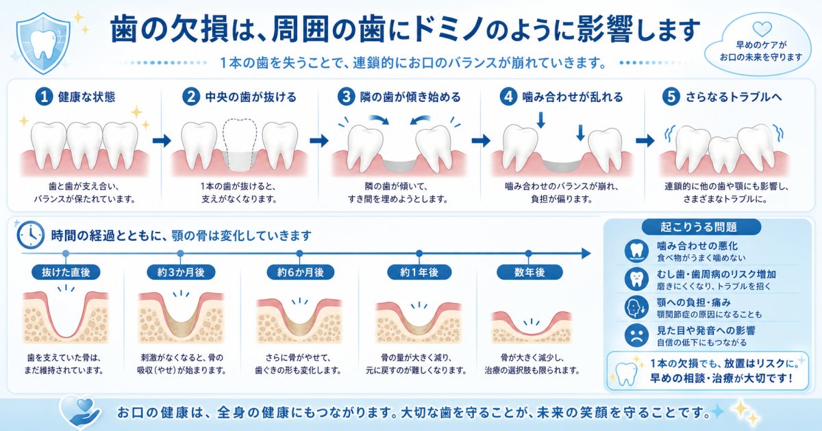 歯の放置でドミノ崩壊？40代が知るべきリスクと痛くない治療法