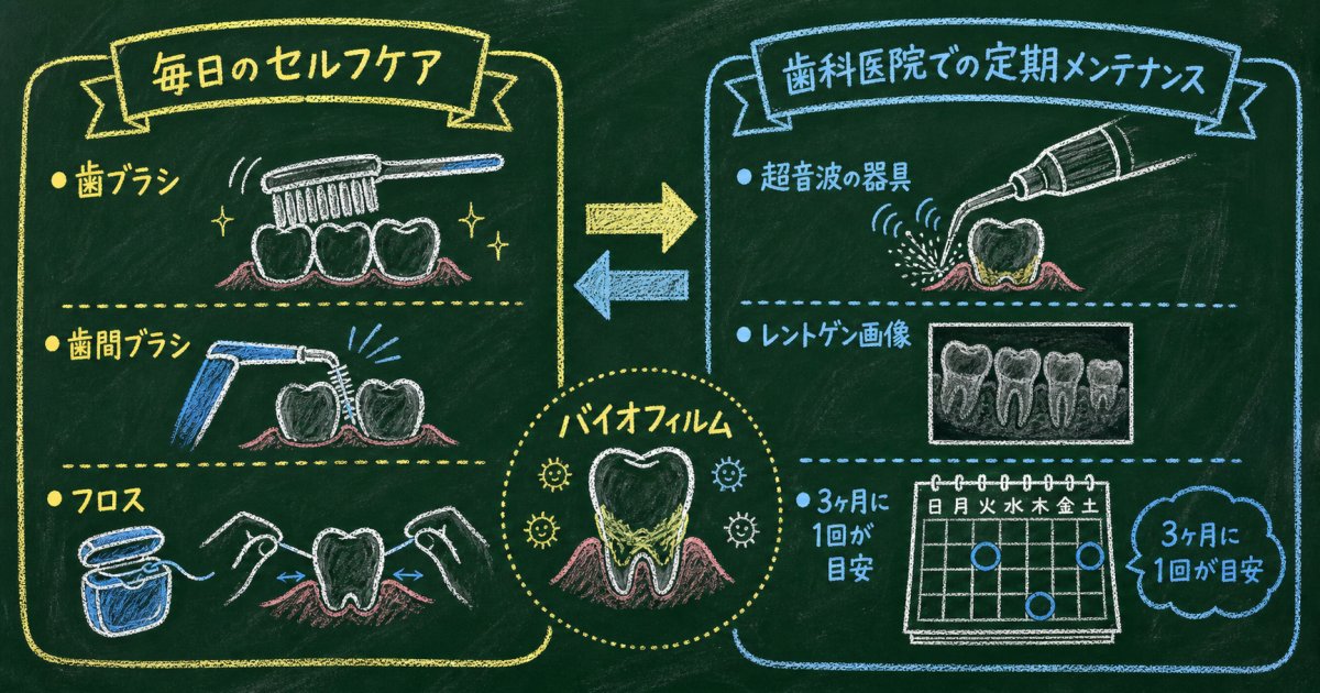 今日から自宅で実践できるインプラント周囲炎の5つの予防法