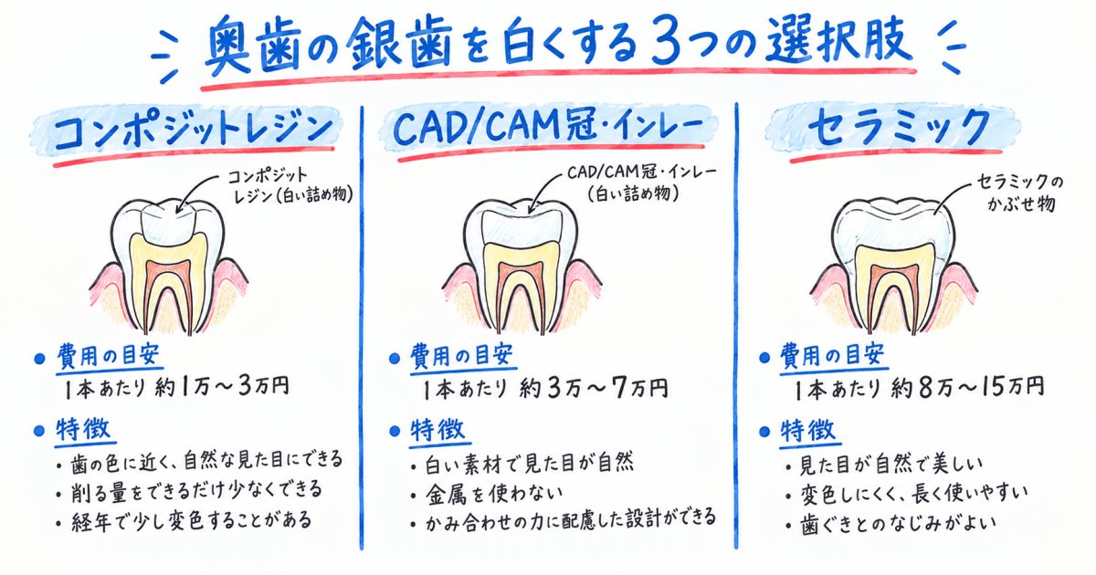 奥歯の銀歯を白くする3つの治療選択肢と特徴