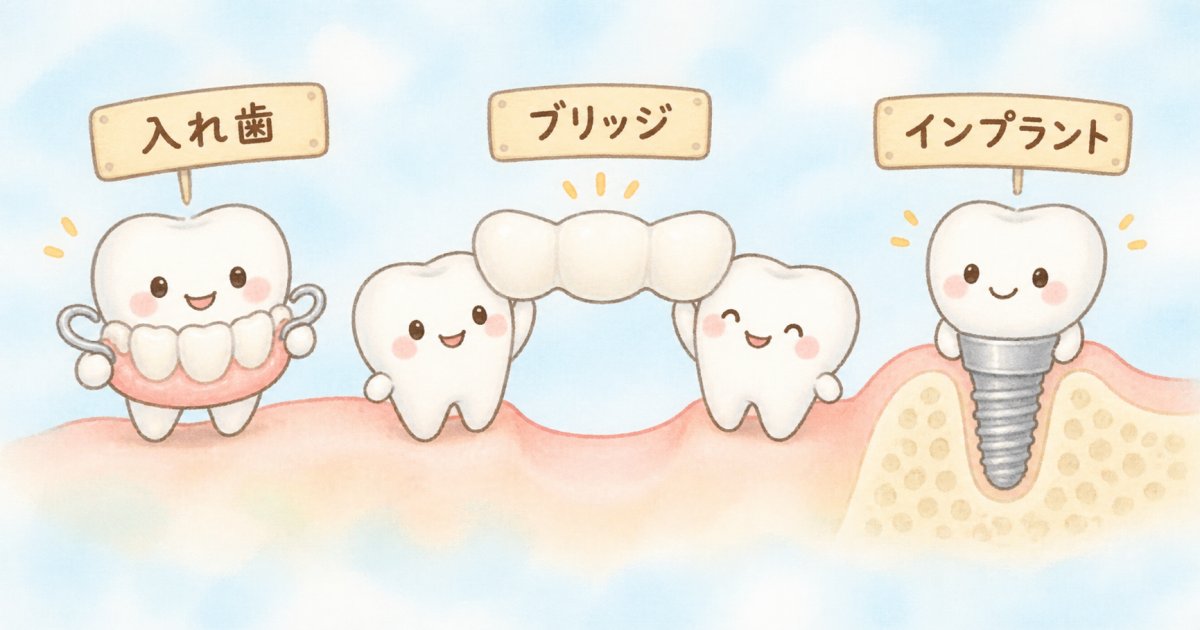 入れ歯・ブリッジ・インプラントは、残る歯にどう関わる?