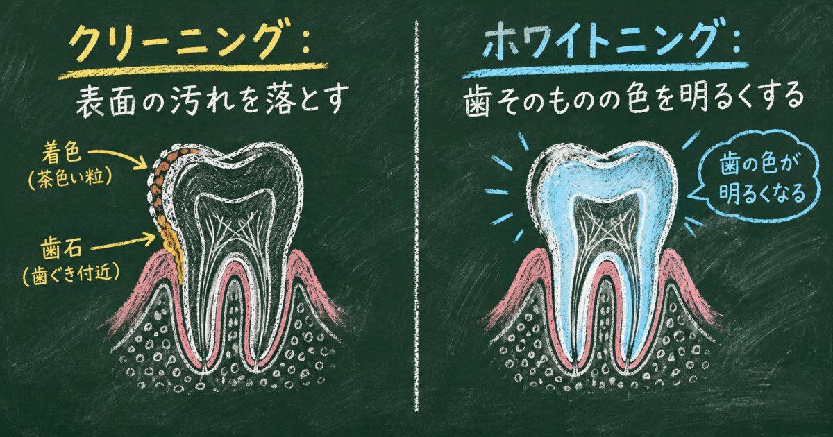 色の変化で見る、クリーニングとホワイトニングの違い