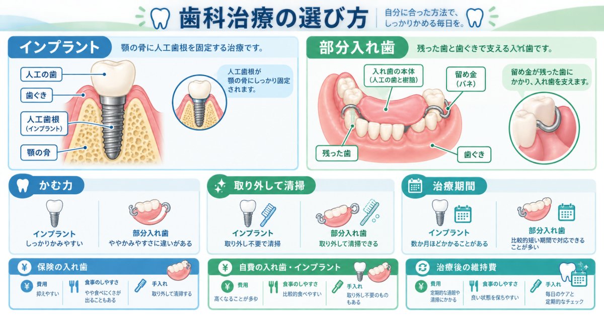 インプラントと入れ歯はどちらを選ぶ？費用と食事のしやすさの違い