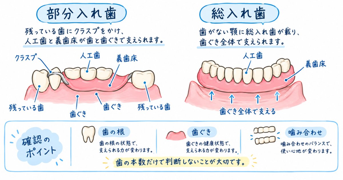 部分入れ歯と総入れ歯の違いは支え方と適応の考え方からわかる